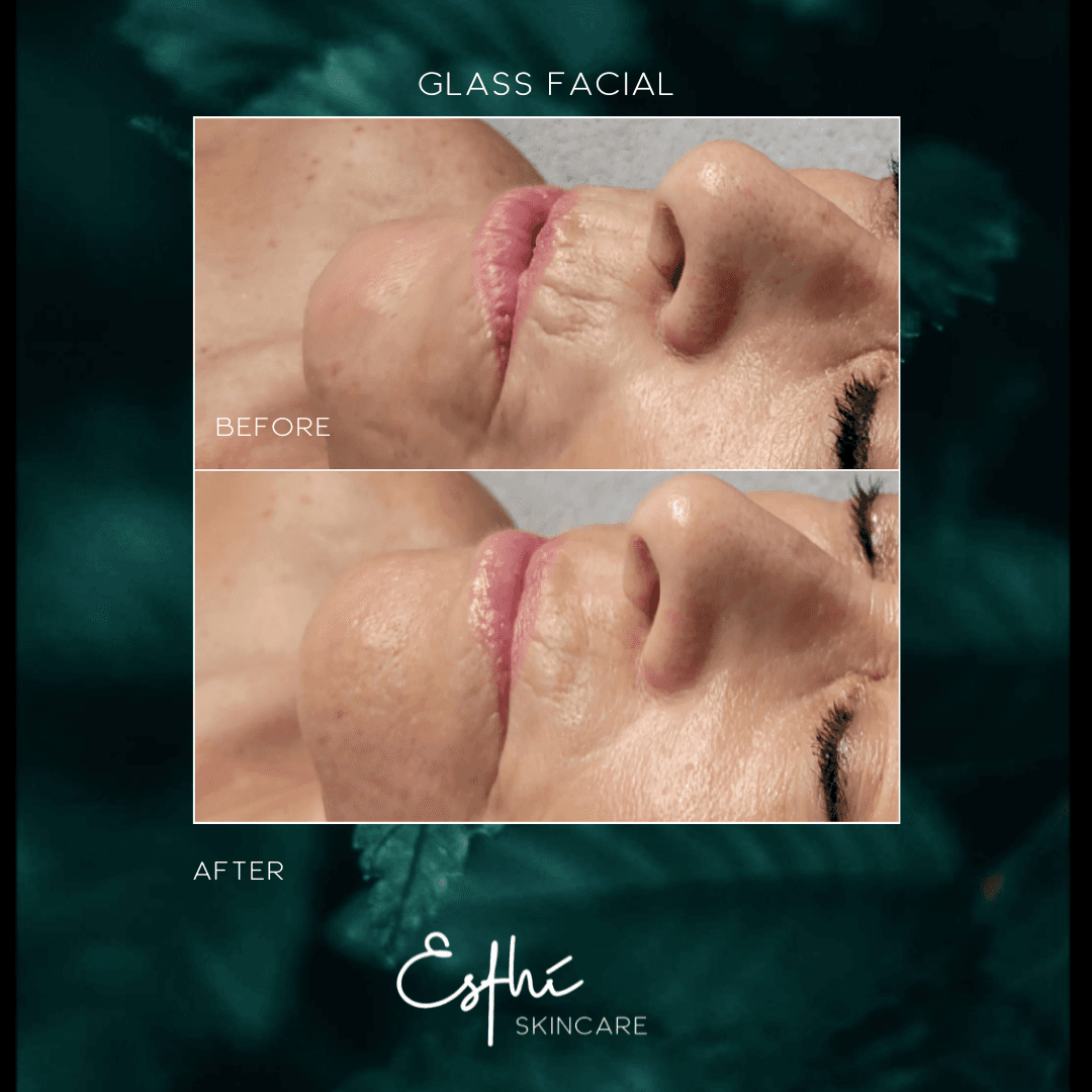 Esthi Skincare - Facials Pinehurst, NC photo 1 of 8