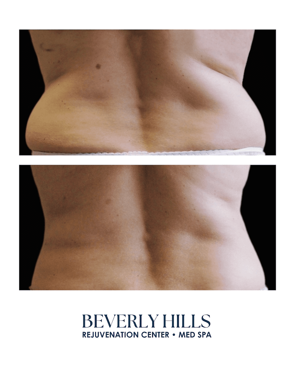 Beverly Hills Rejuvenation Center • Med Spa