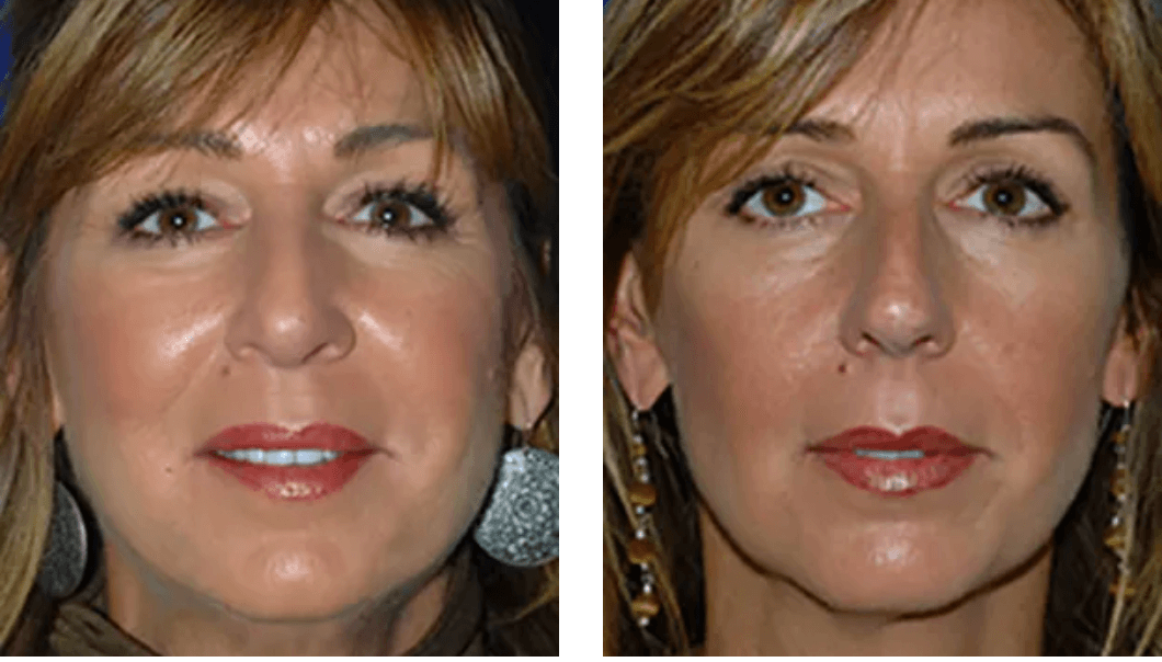Chatham Facial Plastic Surgery & Medical Skin Care, Chatham Donn R MD