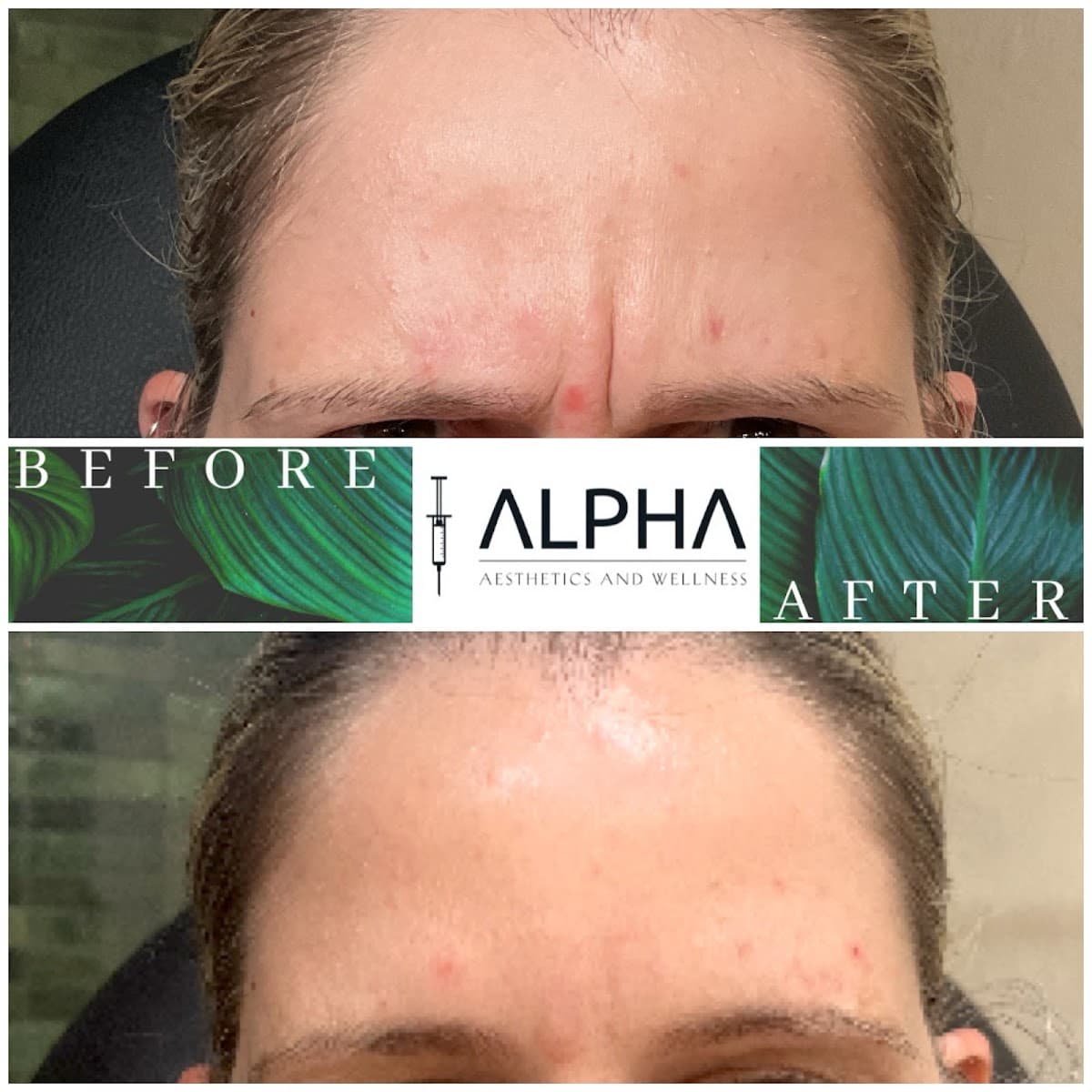 Alpha Aesthetics and Wellness photo 1 of 8