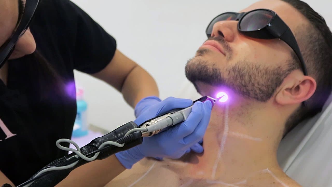 SEV Laser photo 1 of 5
