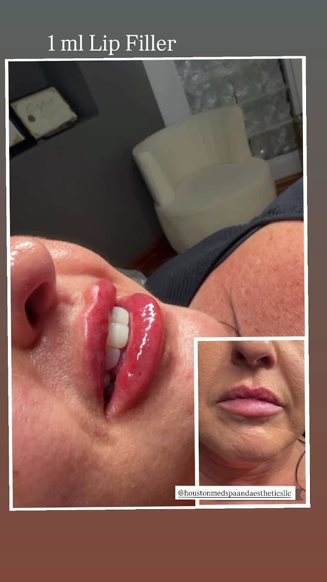 Houston Med Spa and Aesthetics LLC
