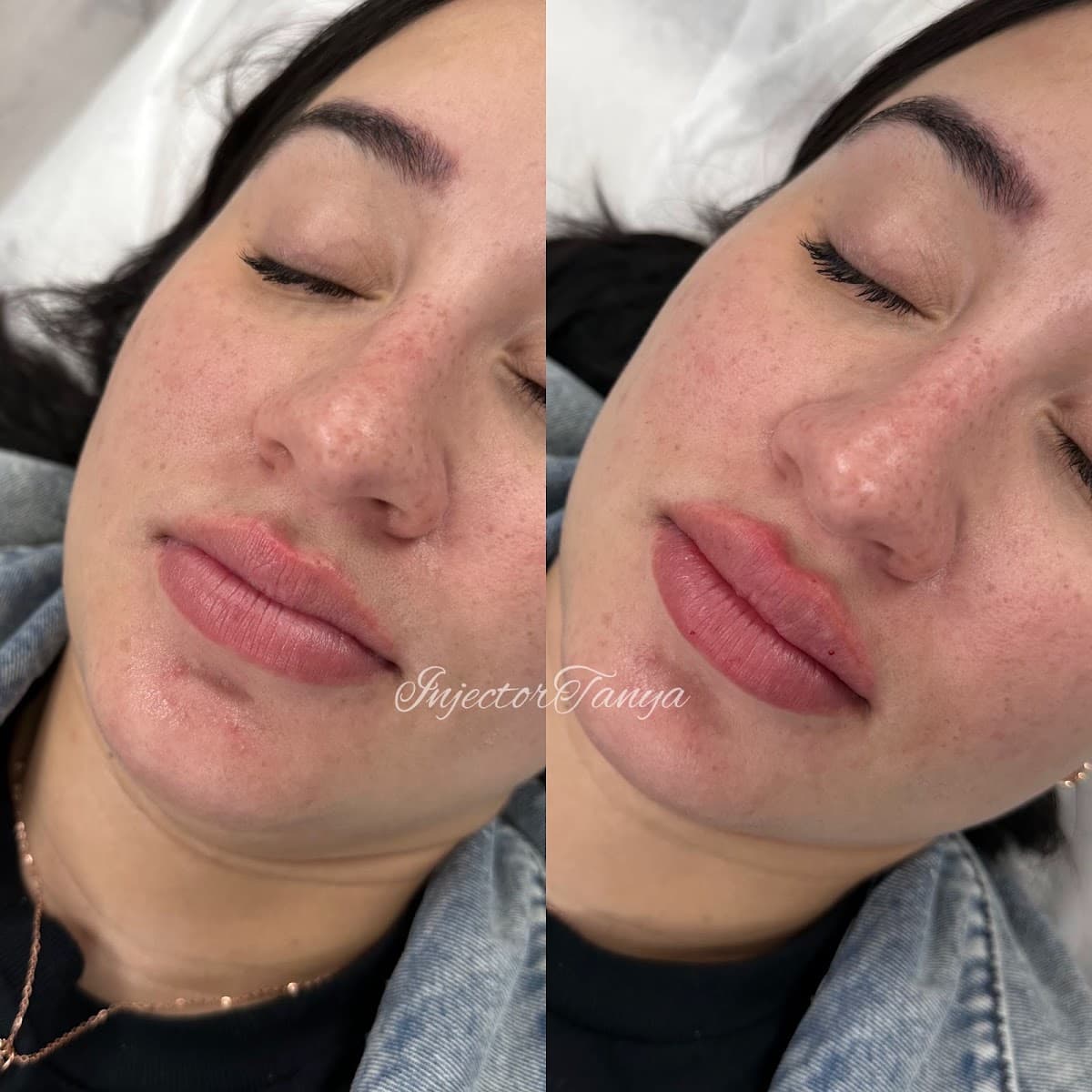 Aesthetica Medspa VA