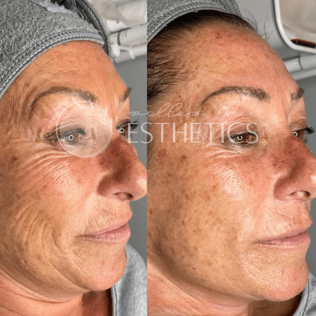 Willow Tree Esthetics