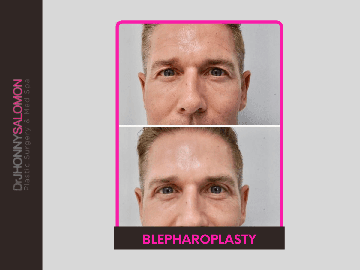 Dr. Jhonny A Salomon Plastic Surgery & Med Spa