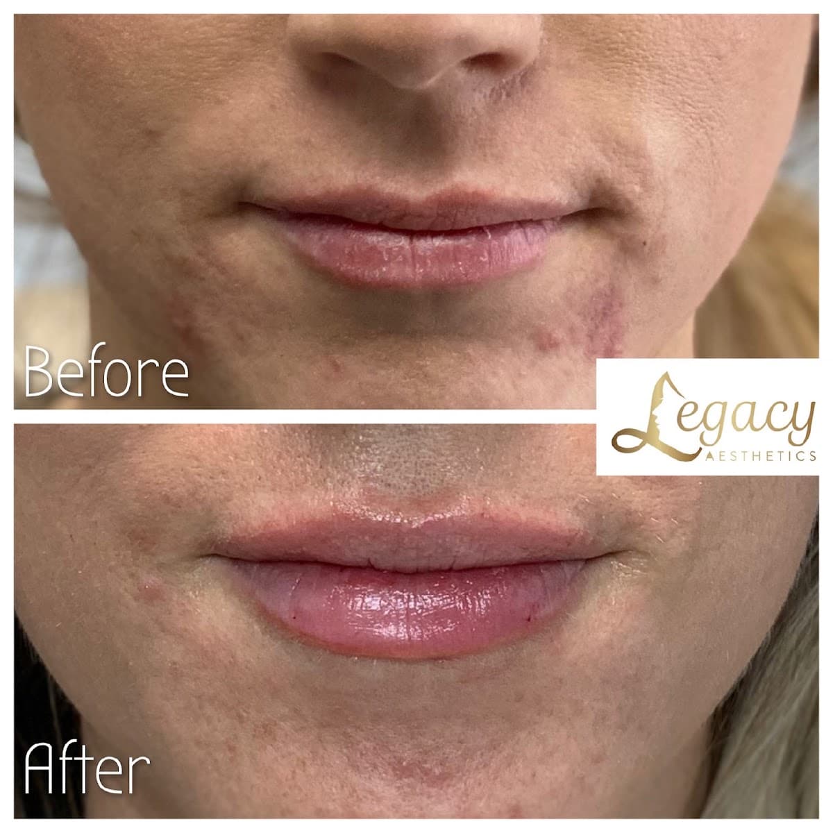 Legacy Aesthetics, LLC