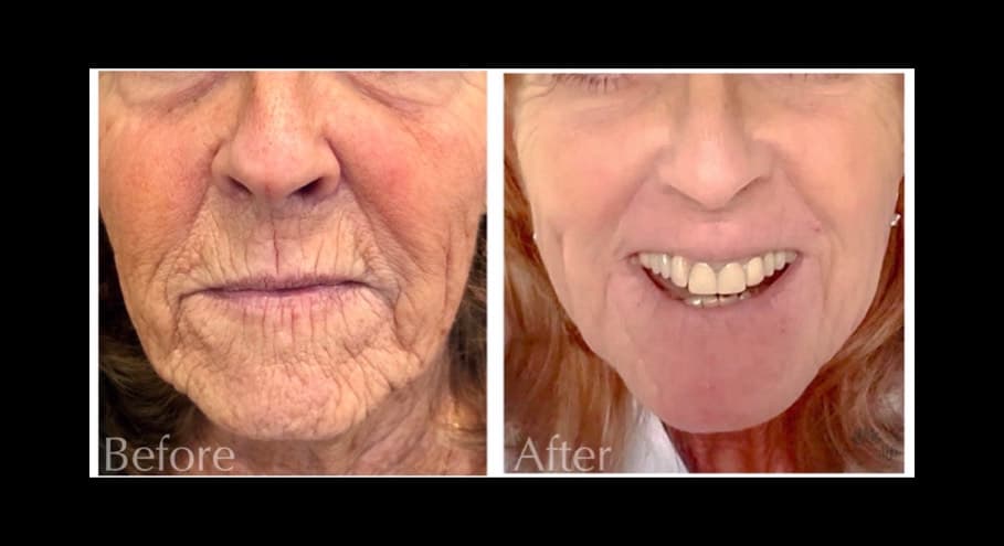 PlasmaLift Skin Clinic photo 1 of 8