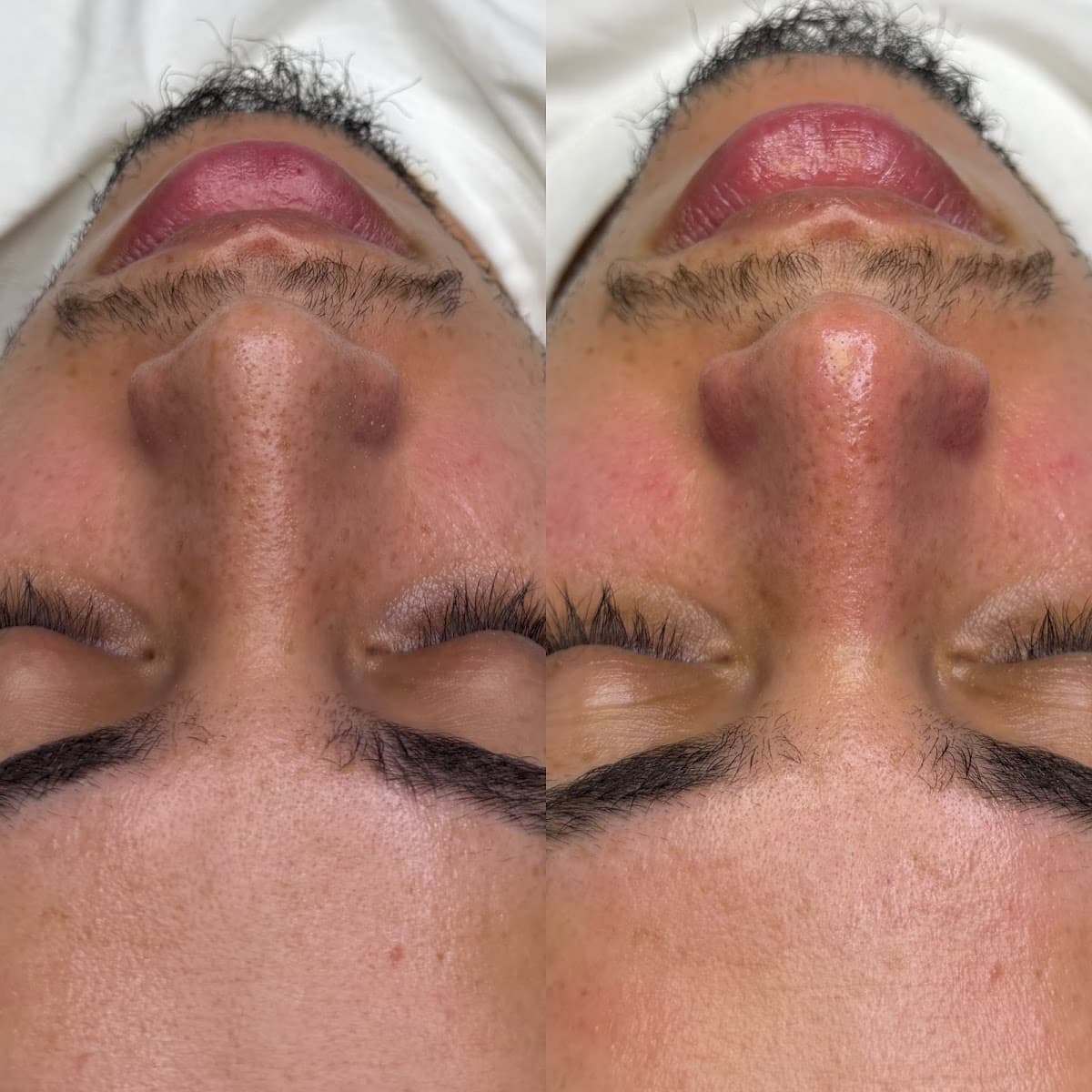 Skin Archive