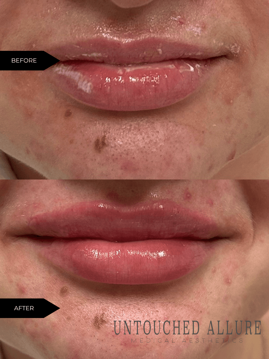 Untouched Allure Medical Aesthetics photo 1 of 7