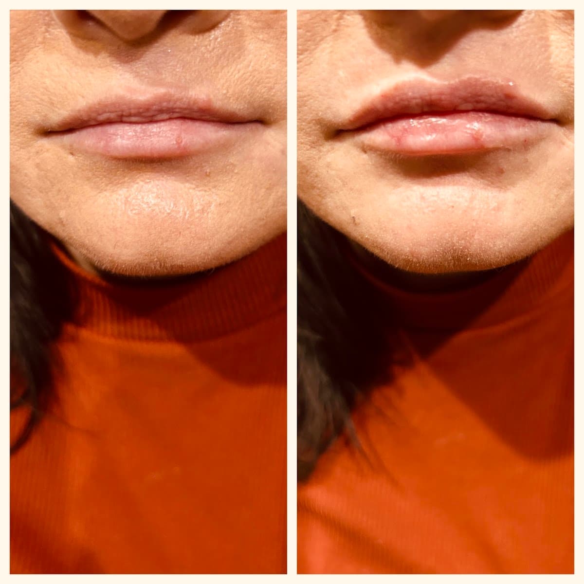 High Expectations Healthcare and Aesthetics PLLC