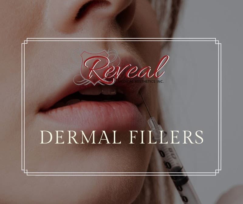 Reveal Medical Aesthetics