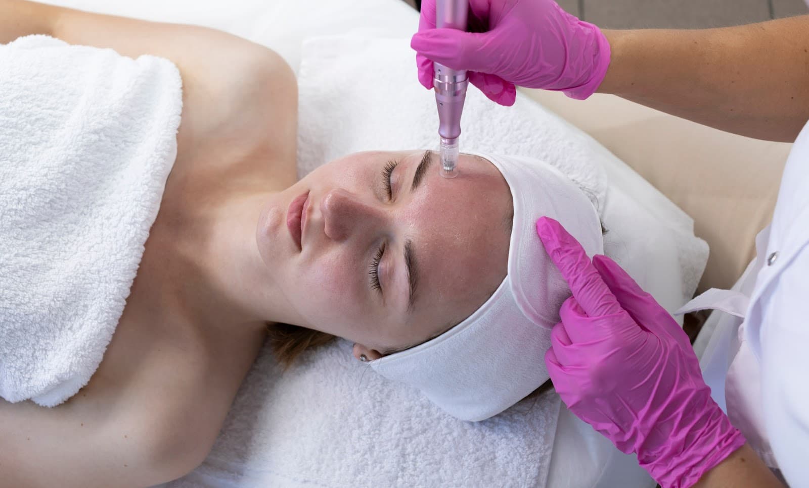 Kansas City Microneedling