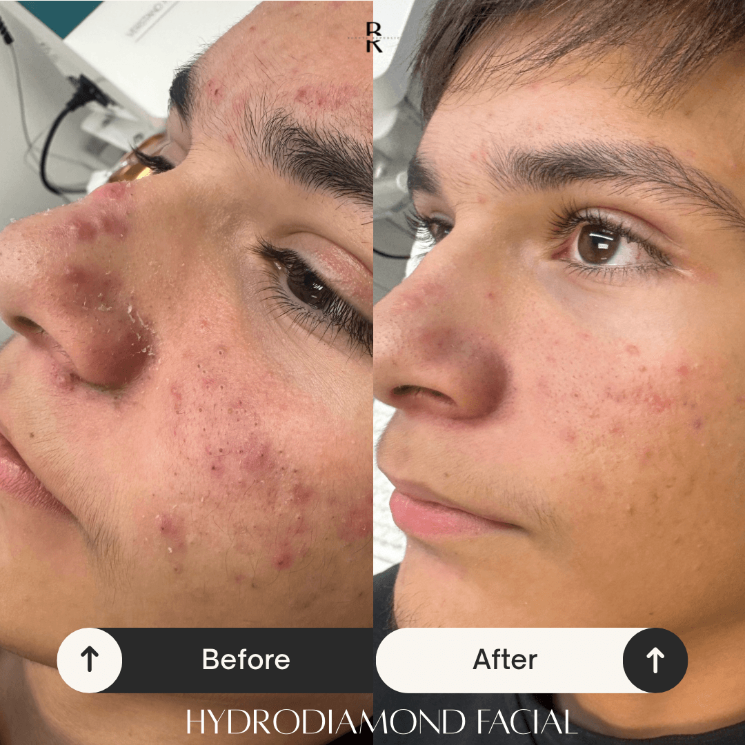 Beauty Republic Med Spa