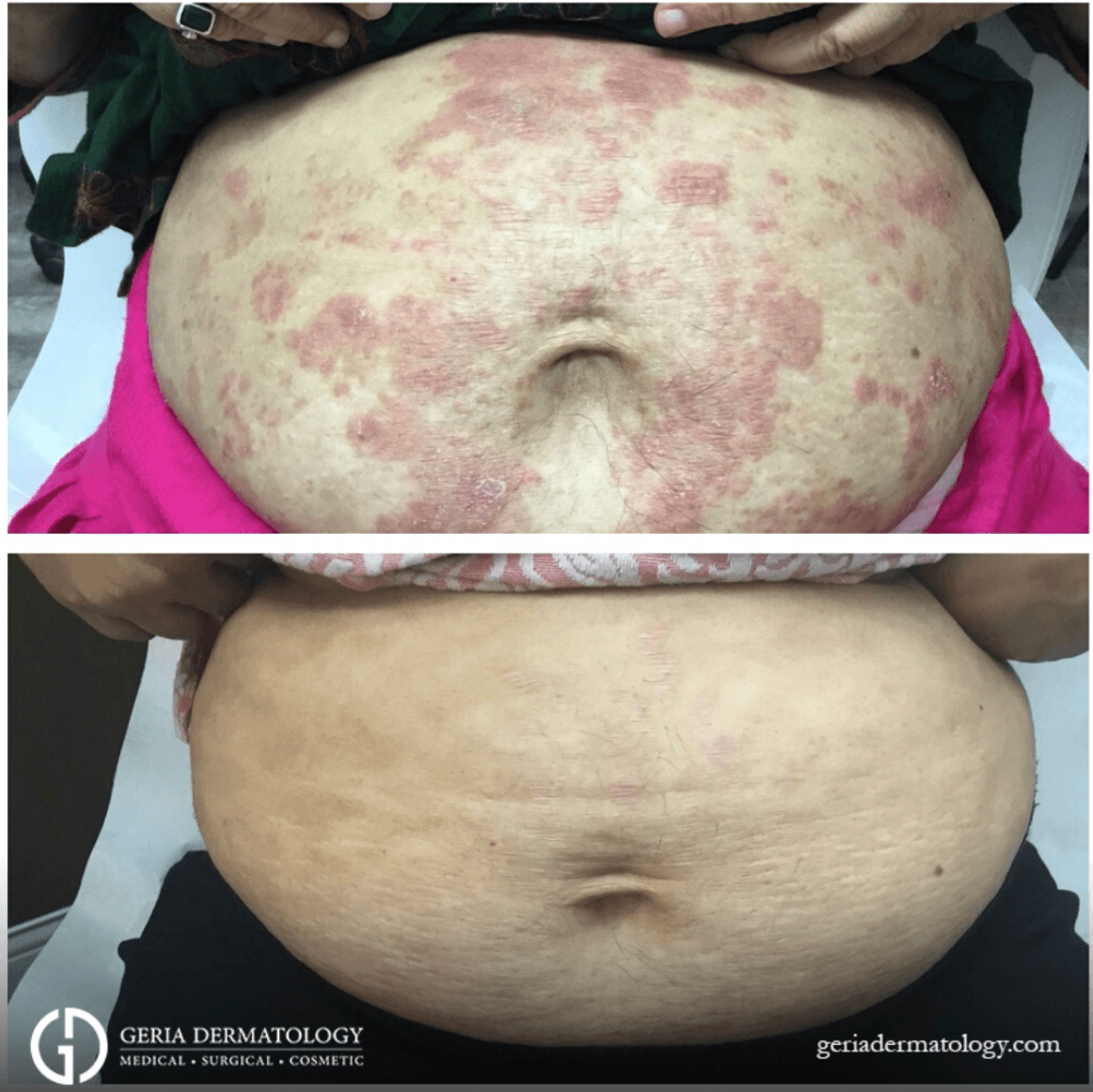 Geria Dermatology - Rutherford