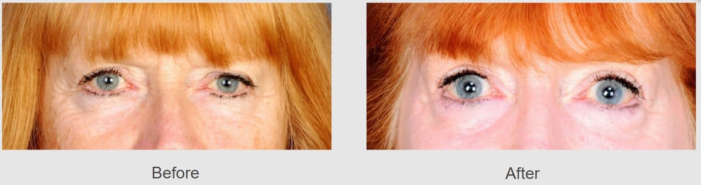 Larrabee Center For Plastic Surgery
