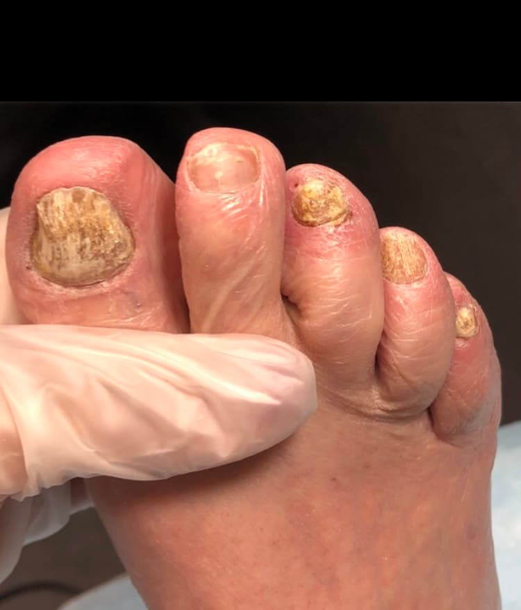 Euro Nails Advanced Medical pedicures photo 1 of 8