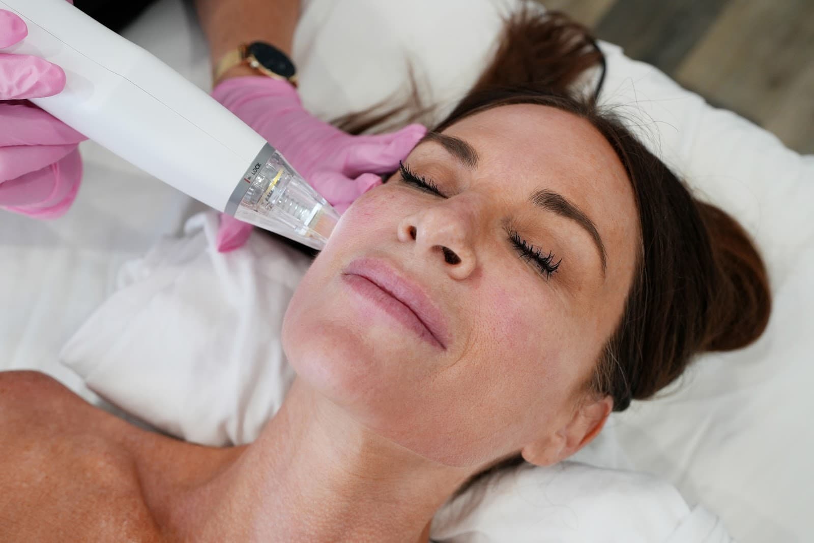 LaserAway Dallas