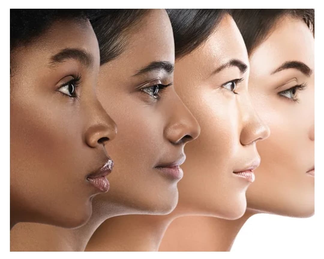 Soft Touch Botox photo 1 of 7
