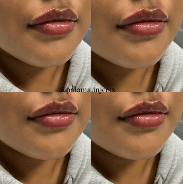 Allure Aesthetics photo 1 of 8