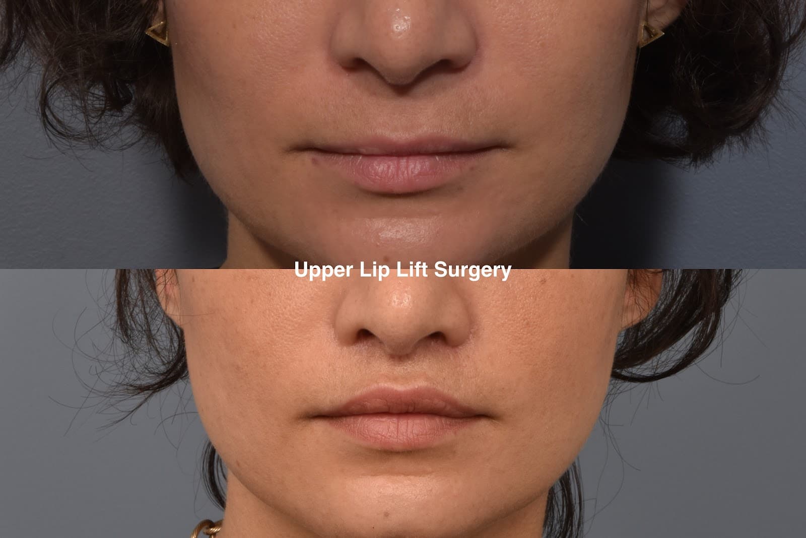 Vegas Facial Plastics - Mehdi Sina MD, MBA photo 1 of 8