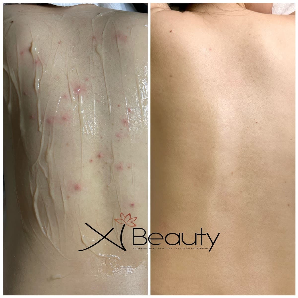 Xi Beauty