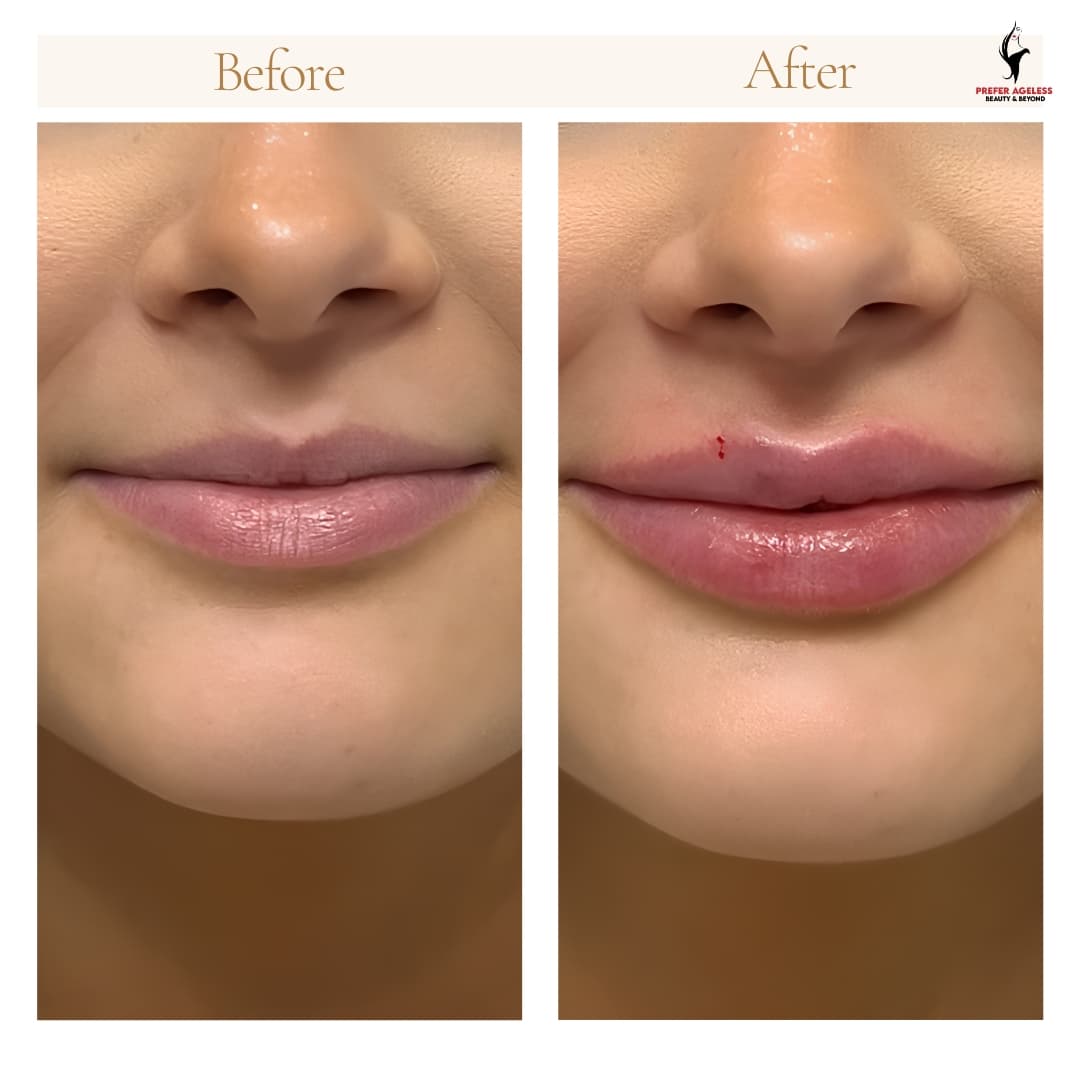 Prefer Ageless Beauty & Beyond