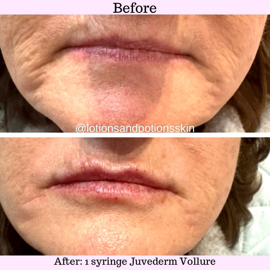 Lotions & Potions Skin Therapy