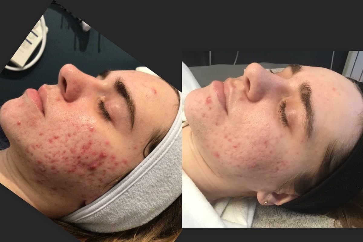 Fresh Faces Rx | Advanced Aesthetics in Lake Oswego | Dr JoDee M Anderson MD