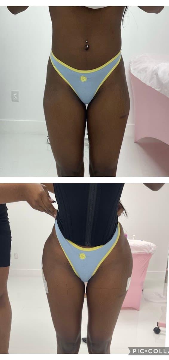 New Body Med Spa