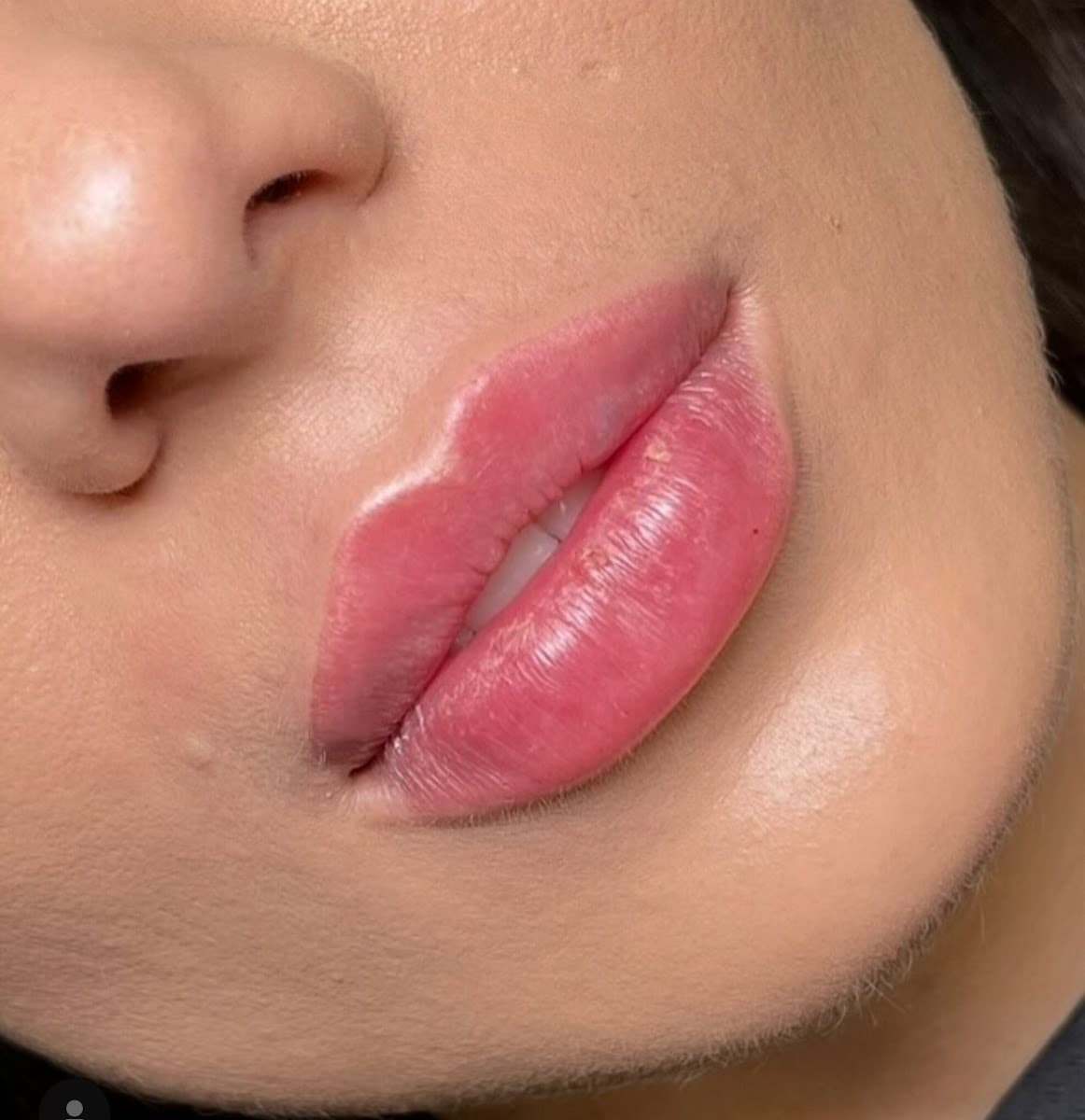Vici Aesthetics