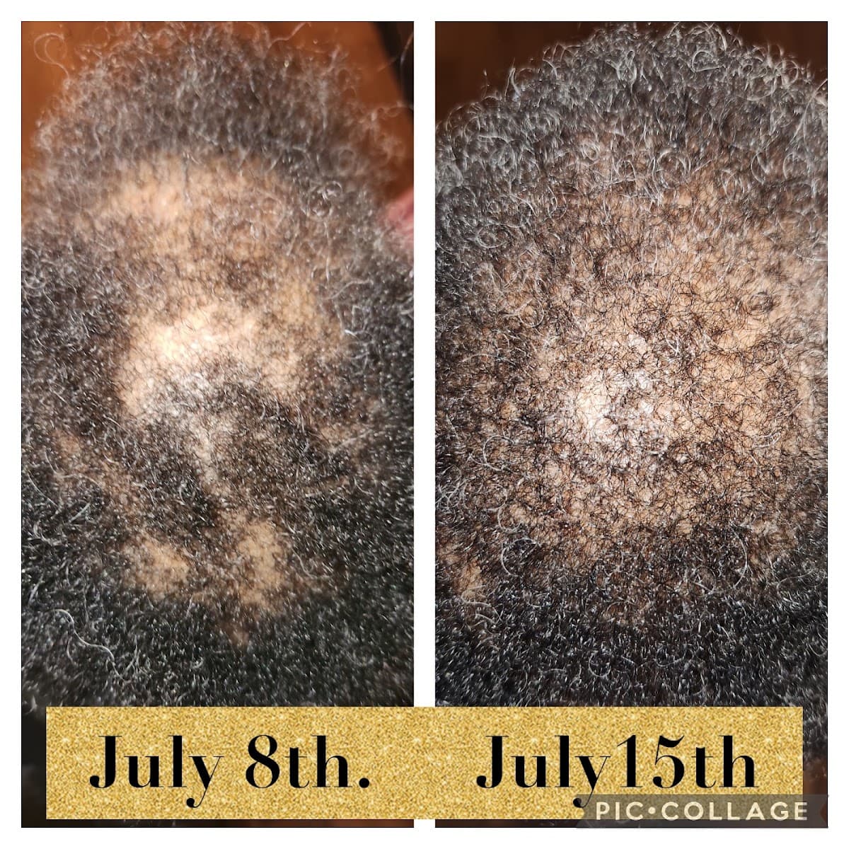 Luxxe Gems Body Contouring by Yvette Da'Stylist