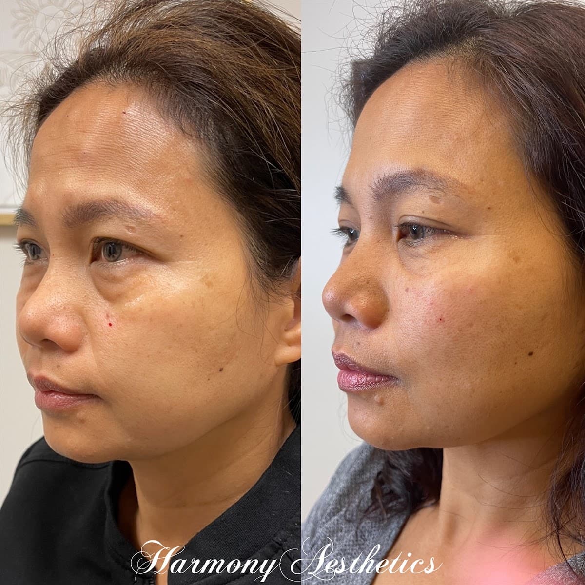 Luxe Beauty & Wellness Med Spa - Tomball