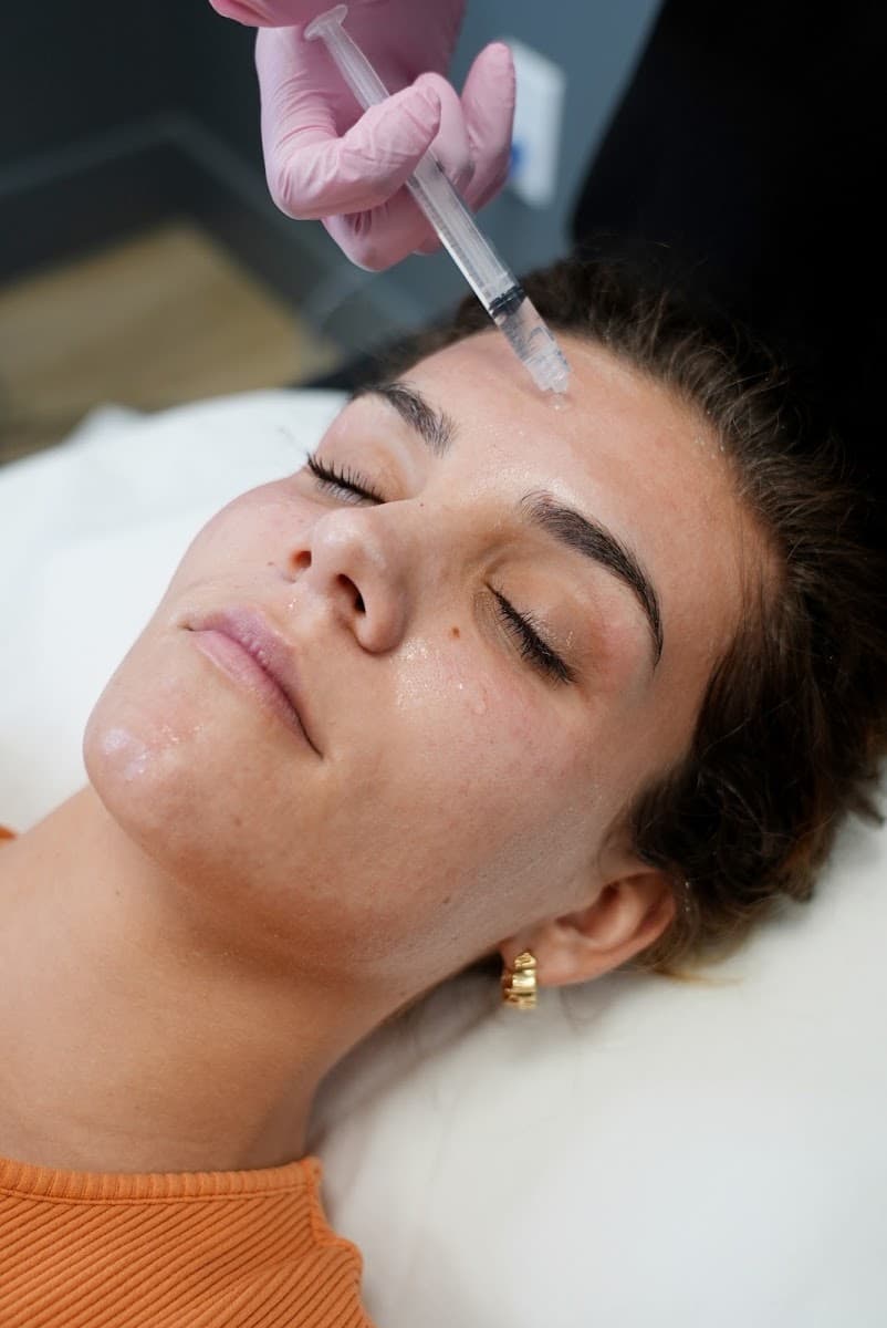 LaserAway Temecula