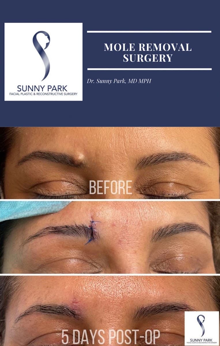 Sunny Park Facial Plastic Surgery photo 1 of 8