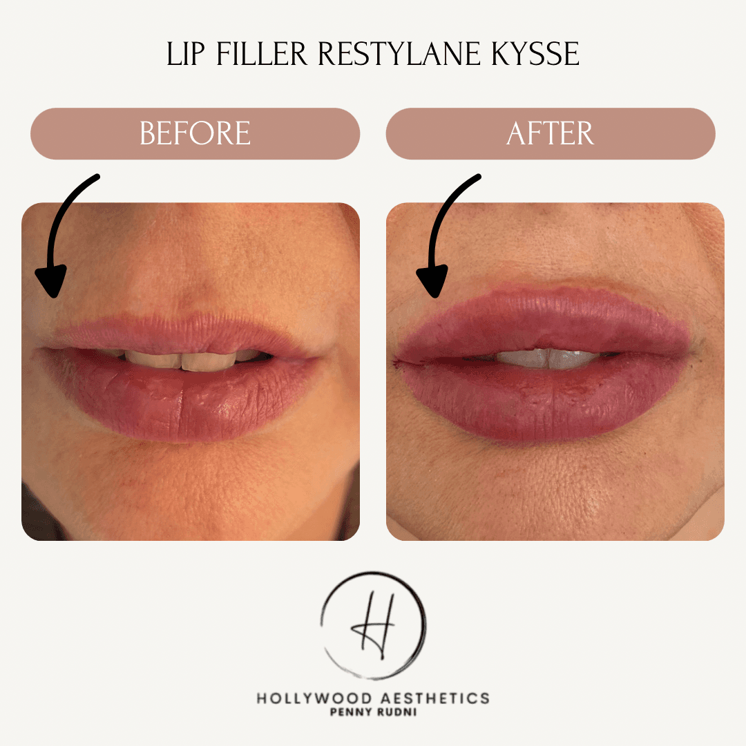 Hollywood Aesthetics photo 1 of 7