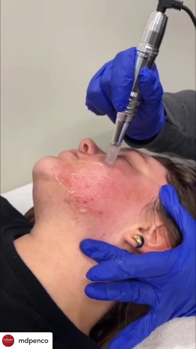 Elvine Medspa photo 1 of 6