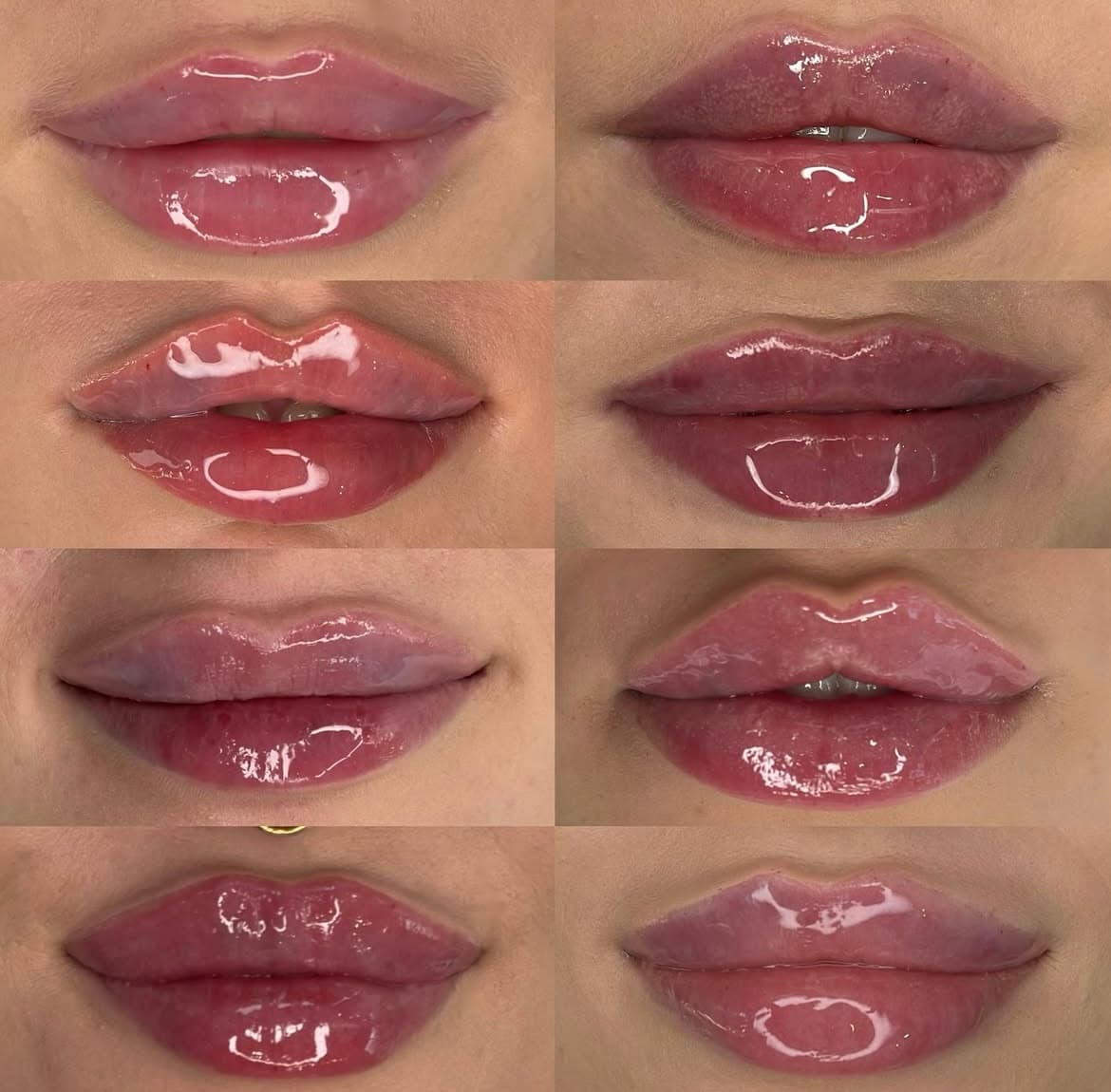Luxe Beauty Medspa