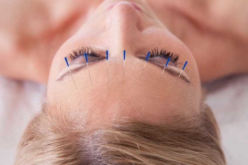 Get Your Qi On Acupuncture photo 1 of 6