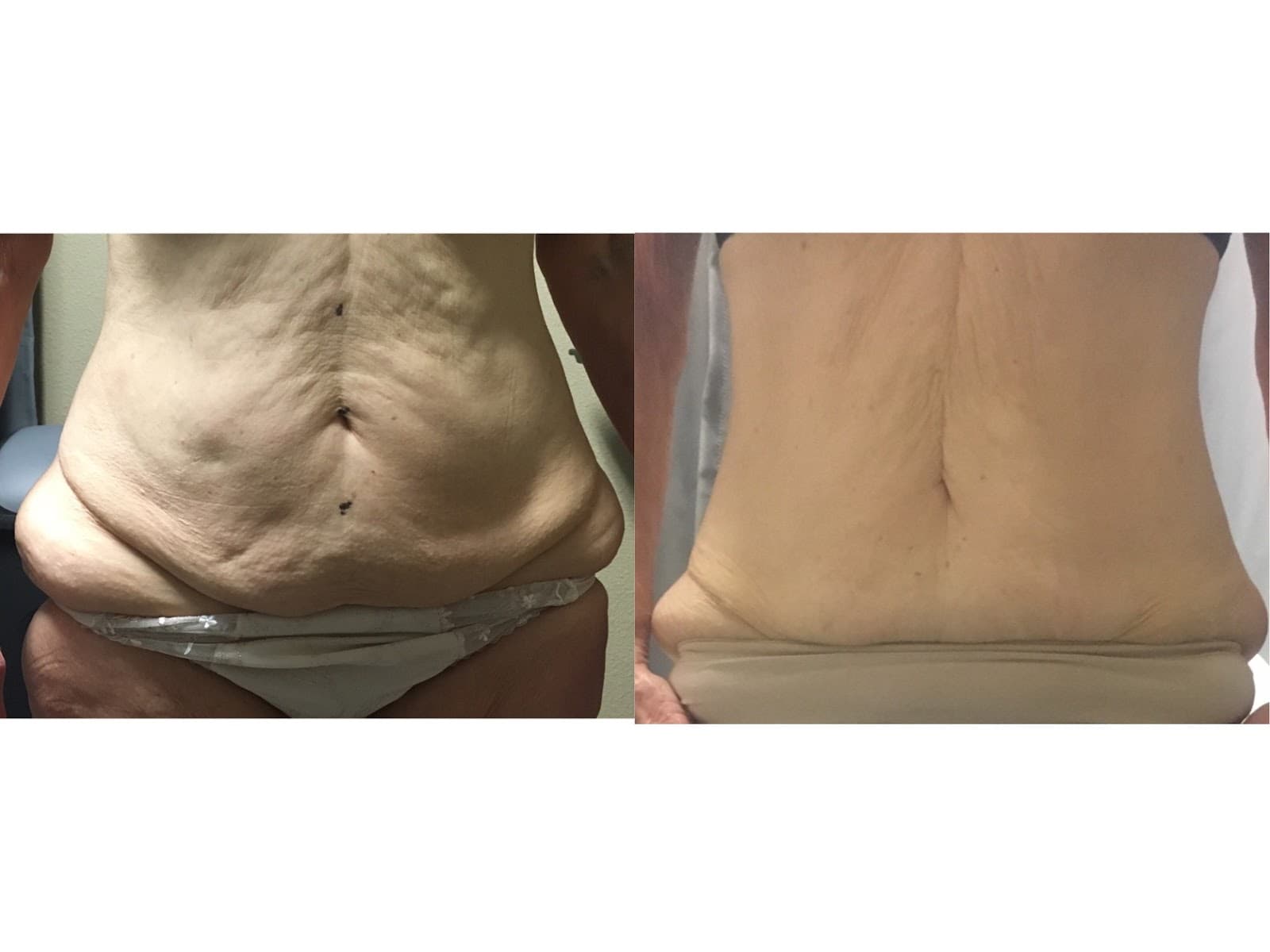 Define Body Contouring and Weight Loss photo 1 of 8