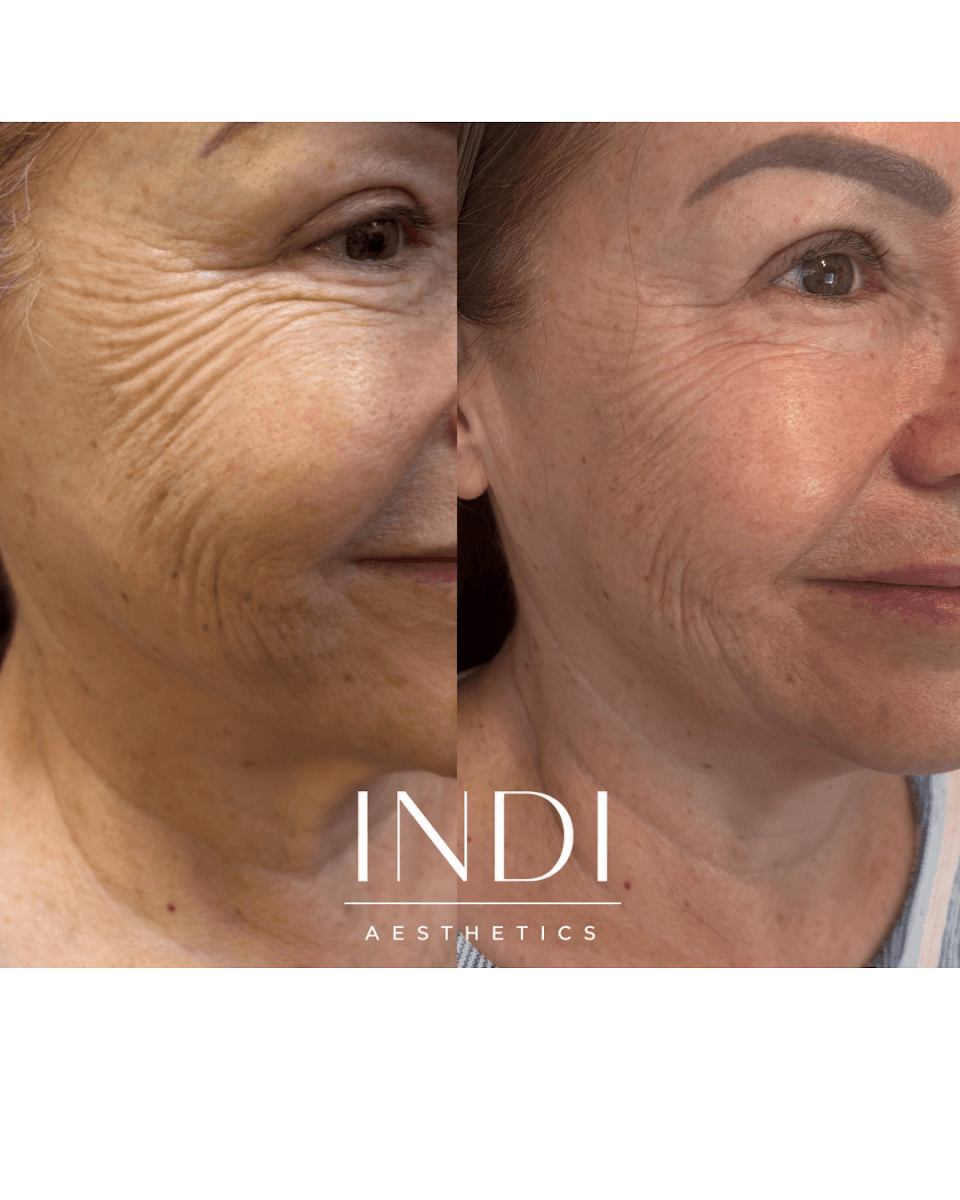 INDI Aesthetics photo 1 of 8