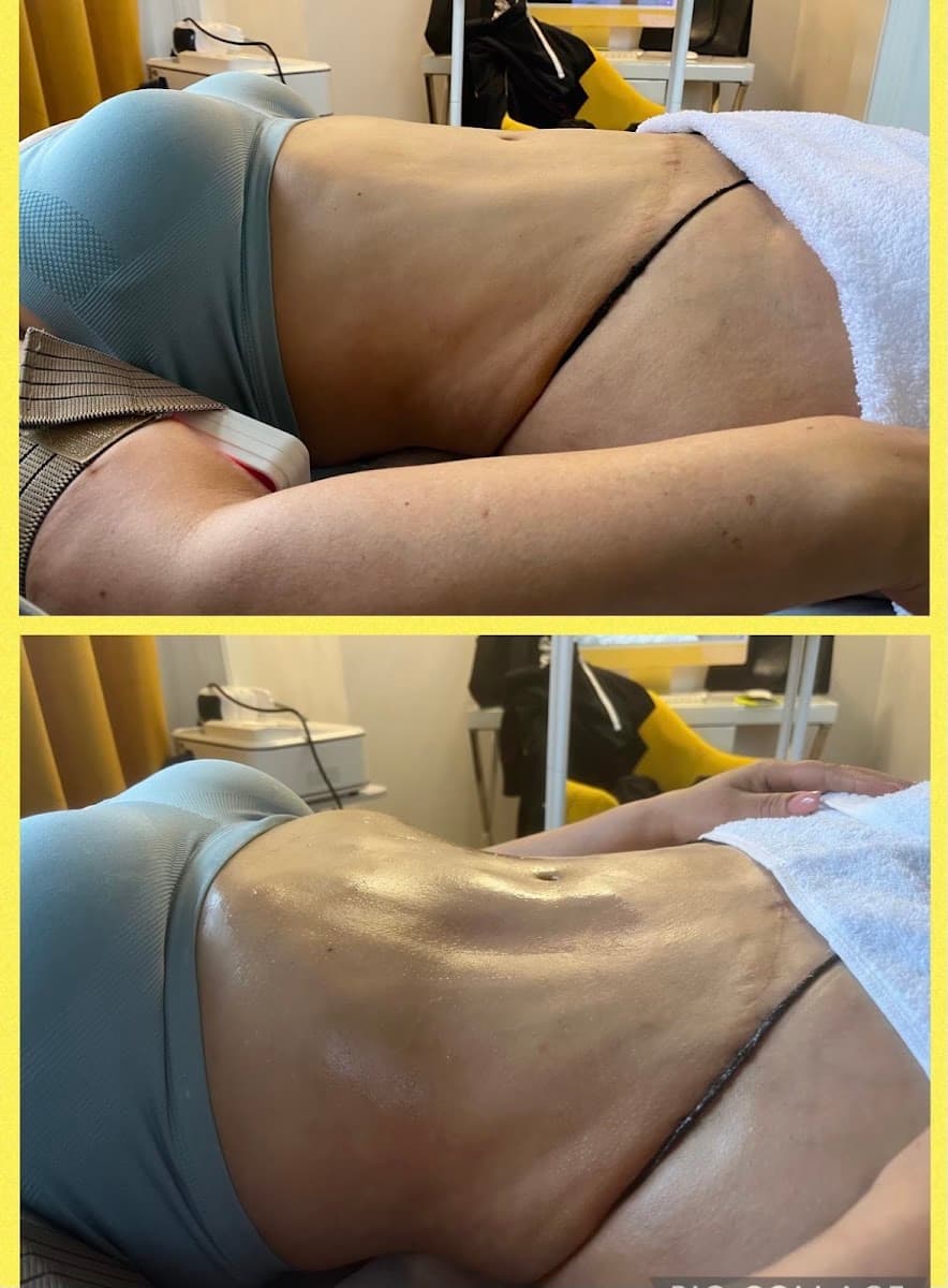 Pretty Pineapple Beauty Bar Post-Op Care