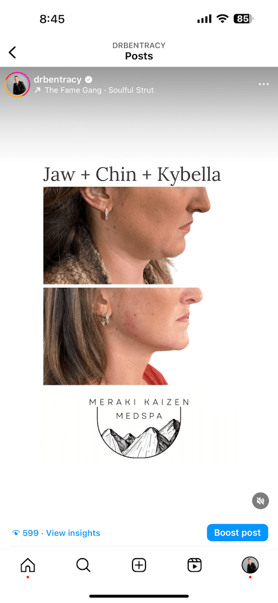 Meraki Kaizen Medspa