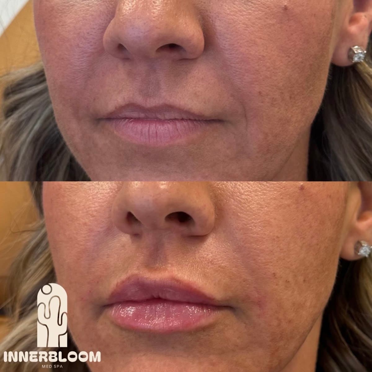 INNERBLOOM Med Spa