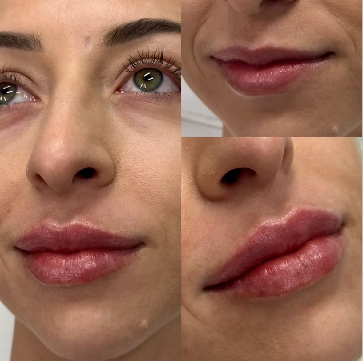 Le Mar Aesthetics - Kendall MedSpa photo 1 of 8