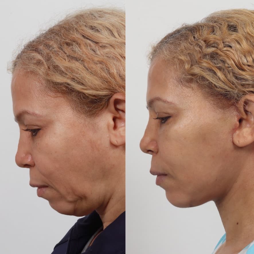 Locketz Facial Plastic Surgery photo 1 of 8