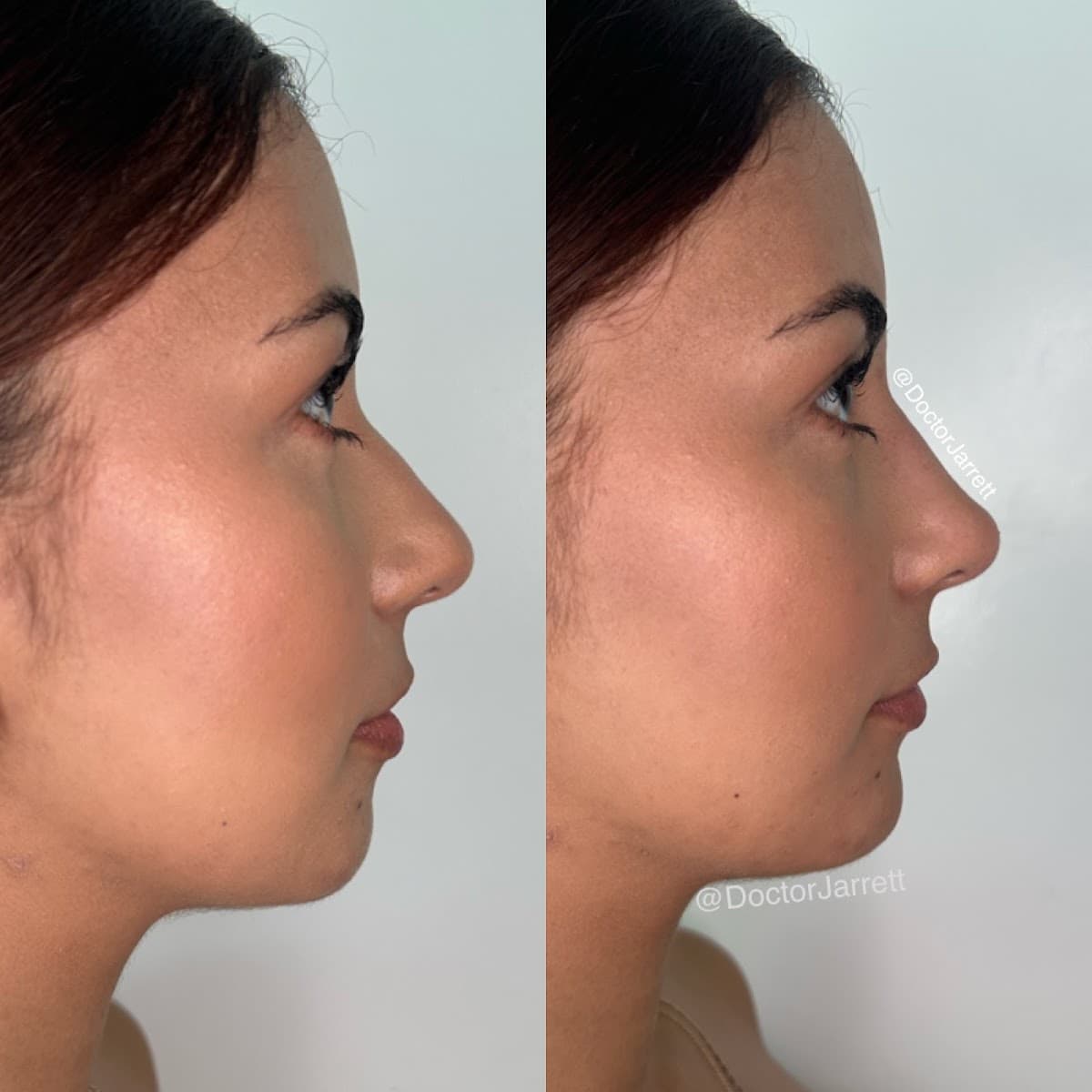 Designer Aesthetics by Dr. Jarrett Schanzer photo 1 of 8