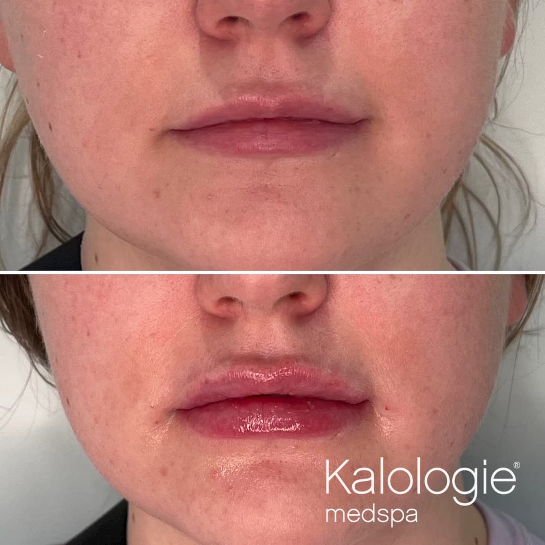 Kalologie | ARIA Resort | IV Therapy & More