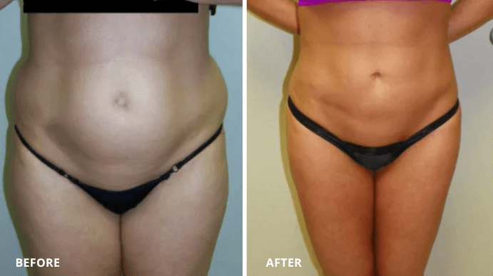 Elysian Plastic Surgery | Male Enhancement & Plastic Surgeon photo 1 of 8