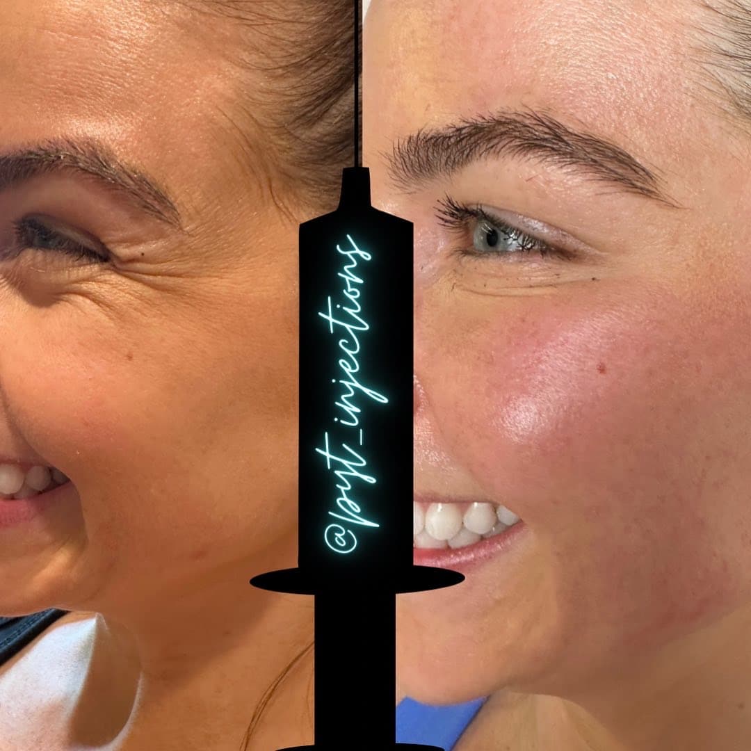 PYT Injections photo 1 of 8