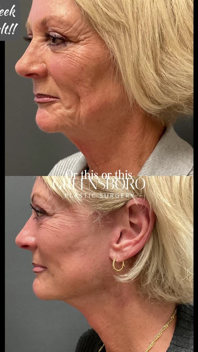 Best Impressions Plastic Surgery